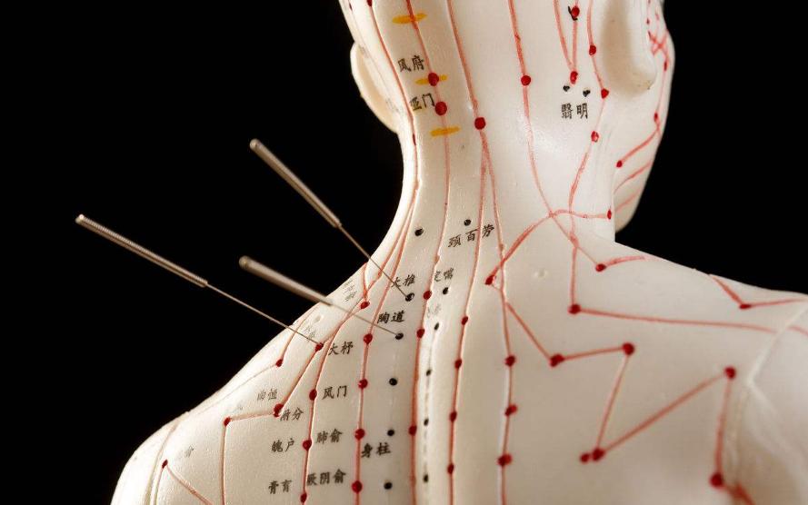 基于“阴病治阳”理论，探析针刺法治疗冠心病的作用