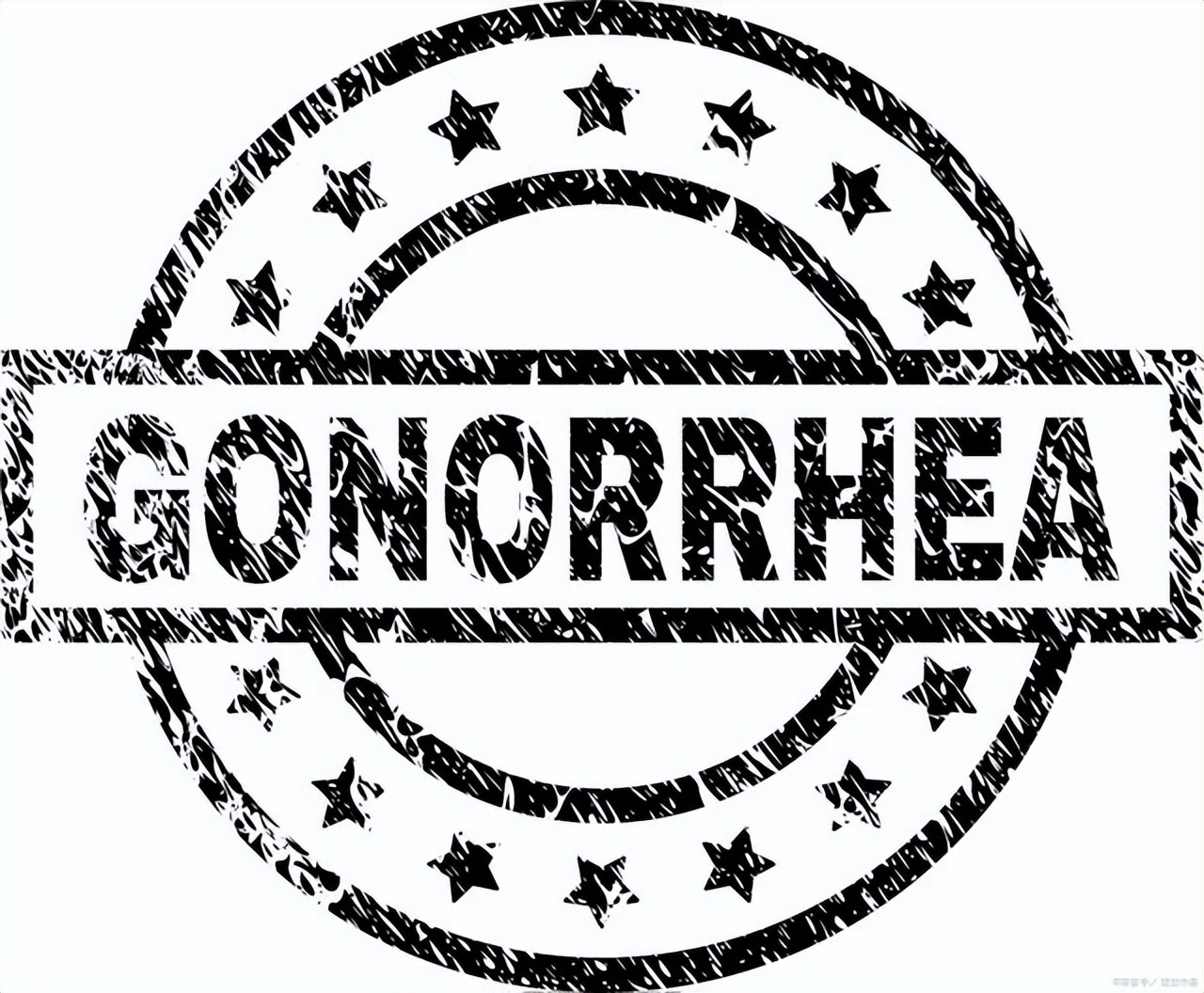 什么是淋病的临床表现,淋病的病因病机是什么