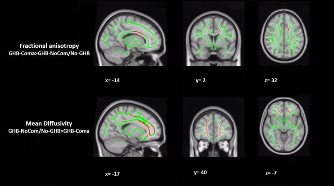 g水是什么意思啊,g水是什么东西