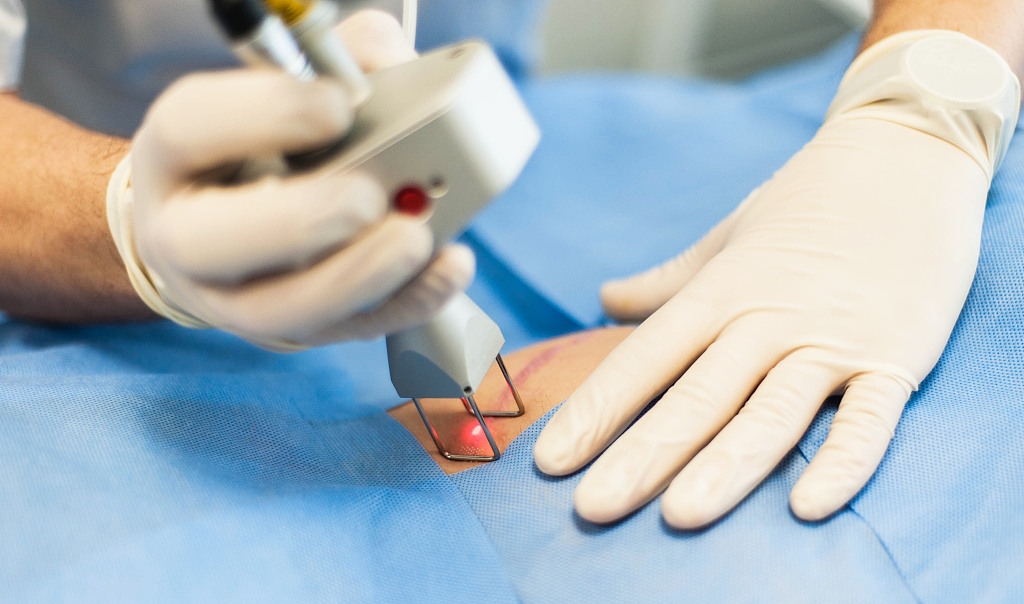 息肉有可能转成癌吗,癌症是息肉转变的吗