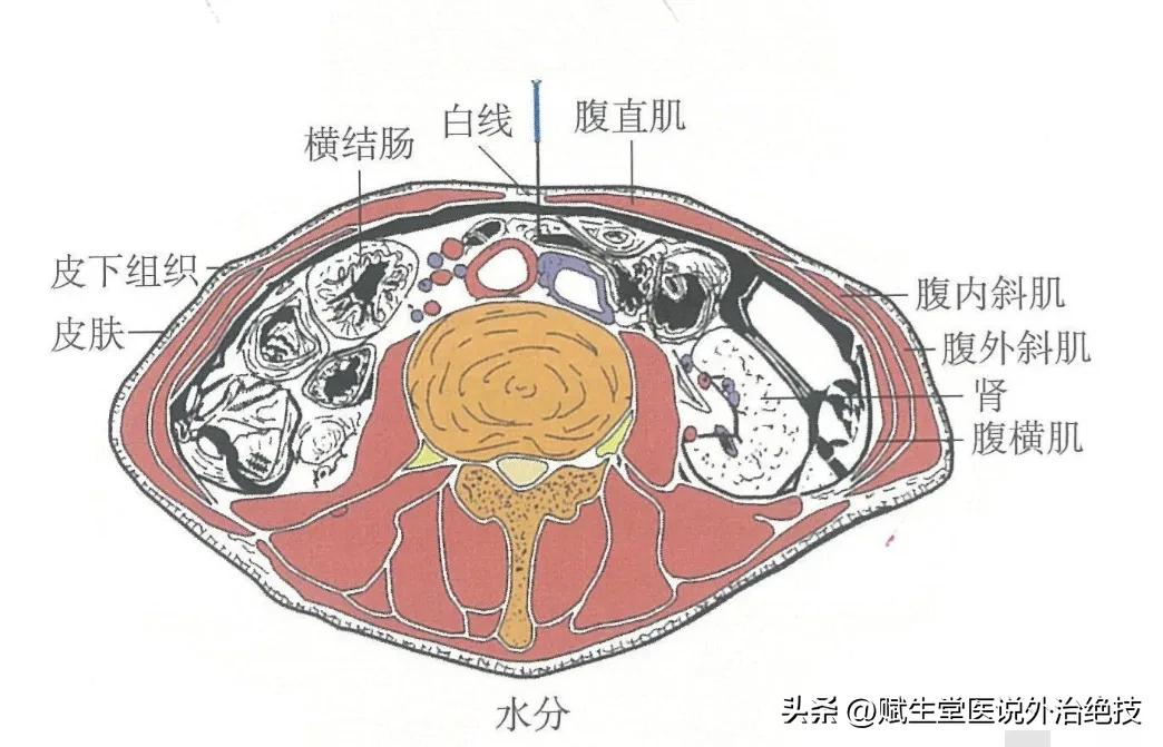 关节腔积液需要休息多久,关节腔积液消除最佳方法