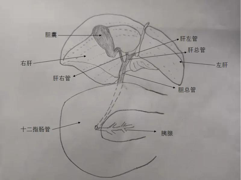 肿瘤患者尿液呈茶色,小便呈茶色尿常规正常