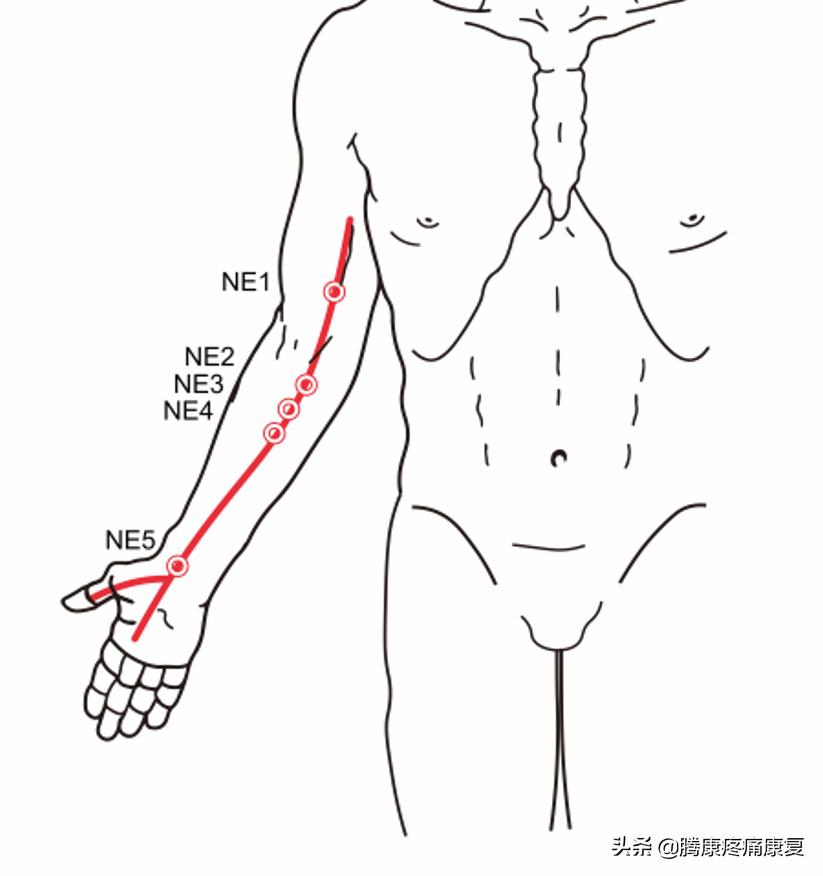 神经性湿疹简单的自愈方法,湿疹病理治疗特效药