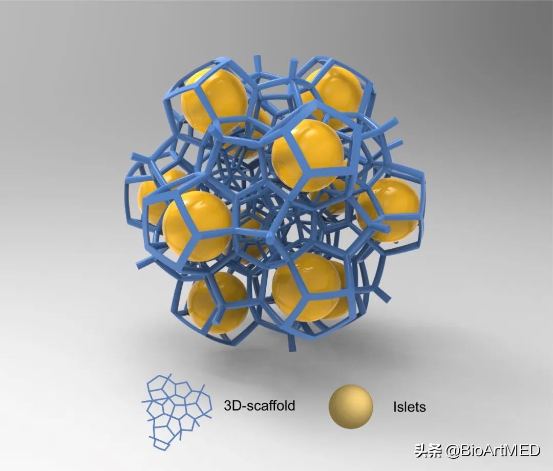 胰岛移植治疗1型糖尿病的前景,糖尿病胰岛细胞再生修复治疗