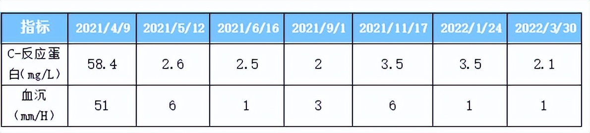 白塞病引起的葡萄膜炎看什么科,白塞病引起的葡萄膜炎治疗的偏方
