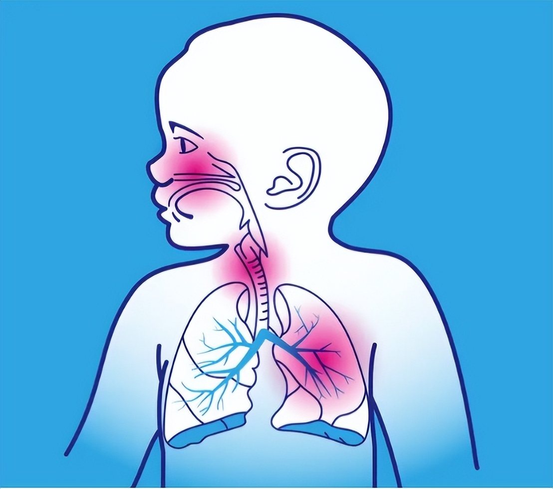 为什么不能随便给孩子用退烧药,孩子用退烧药用多了怎么办