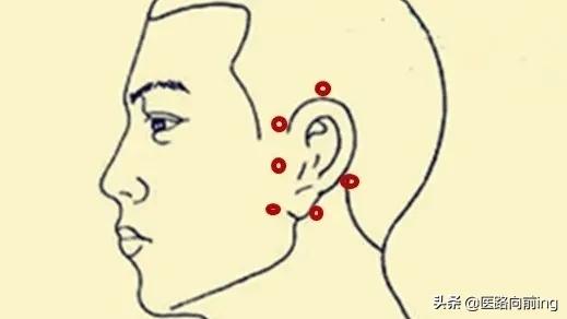 耳鸣耳聋小妙招帮你渡过难关,老年人怎么预防耳聋耳鸣