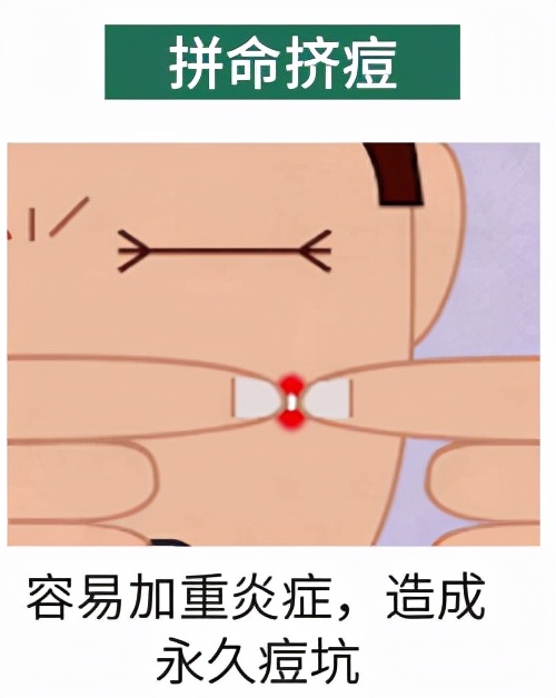 青春痘变疮了要怎么治,治脓包型青春痘偏方