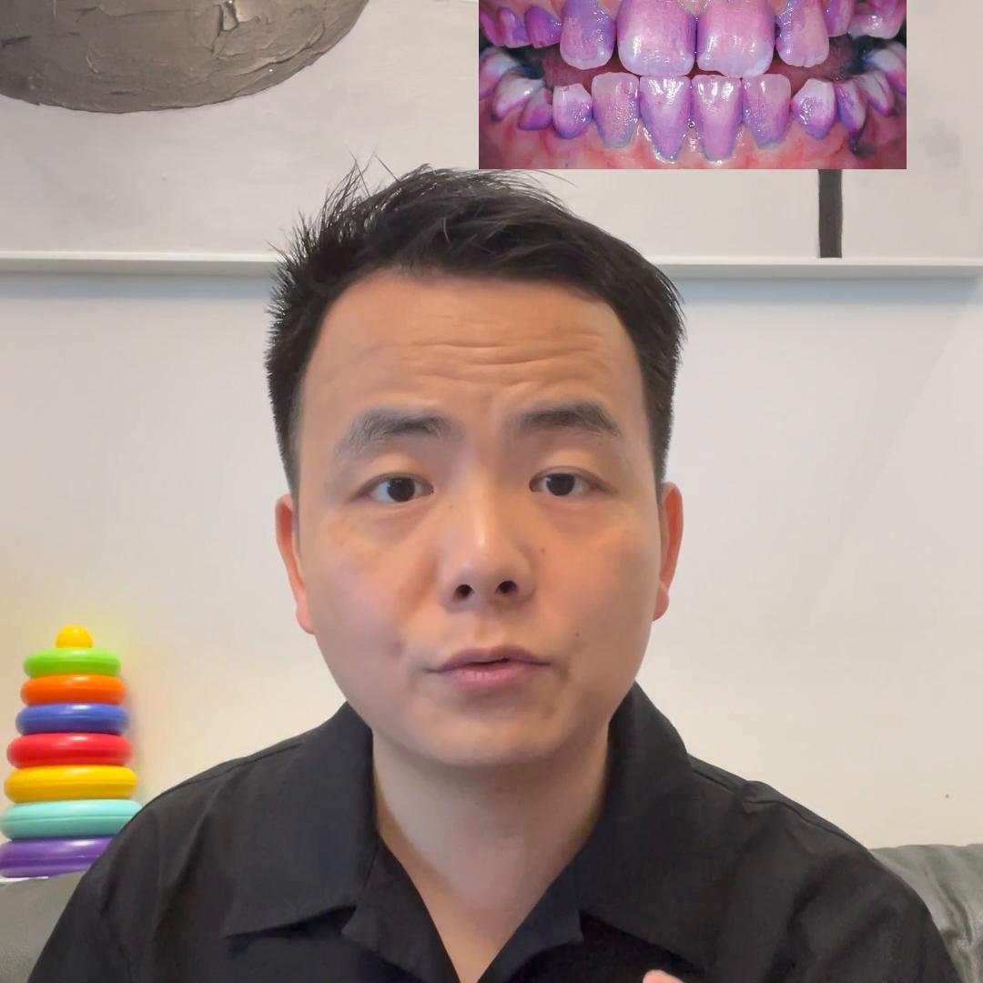 婴儿牙刷0-6个月宝宝怎么刷牙,婴儿刷牙握牙刷的正确姿势