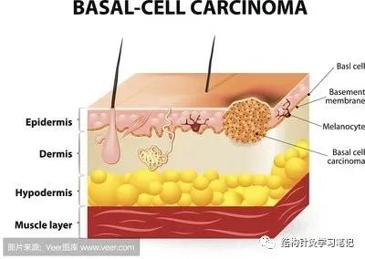 拔罐中的走罐,拔罐走罐视频