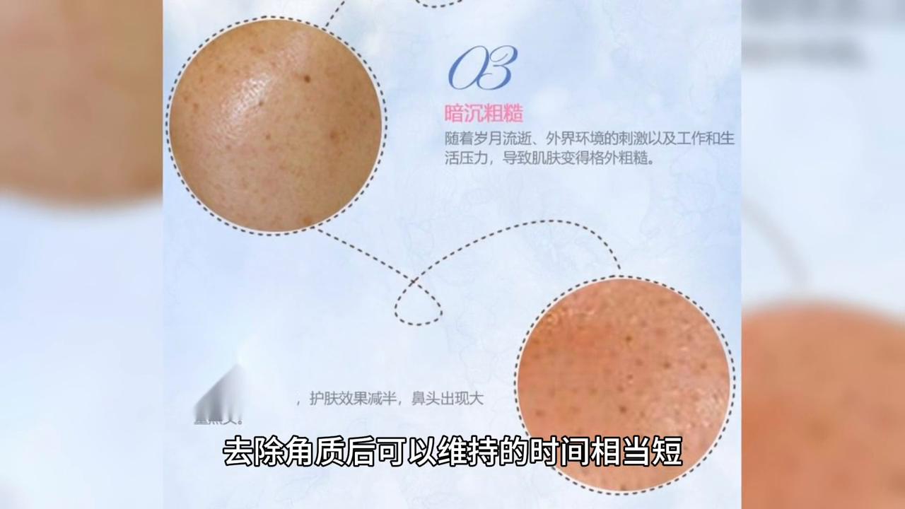 男生脸色发黄毛孔粗大,毛孔粗大皮肤偏黄怎么解决