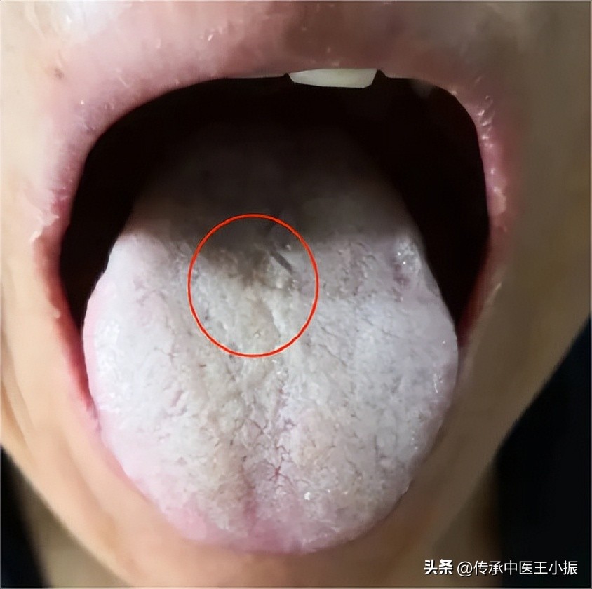 吃附子理中汤排寒反应,脾胃虚寒为什么喝冷水感觉不舒服