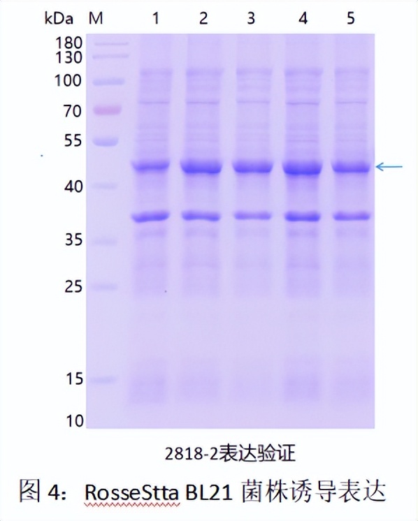 原核表达重组蛋白原理,高中原核蛋白翻译过程