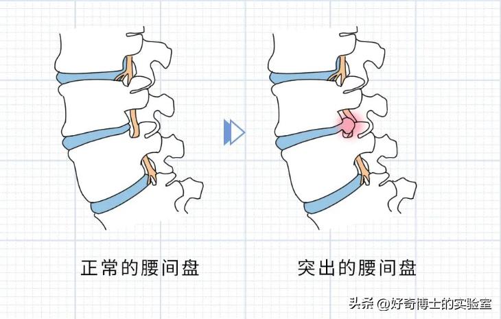 什么姿势能把腰掰响,哪些姿势对腰不好