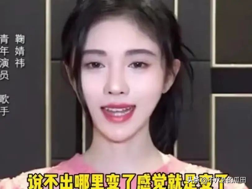 蔡徐坤下巴太尖惹争议图片,蔡徐坤下巴是假体吗