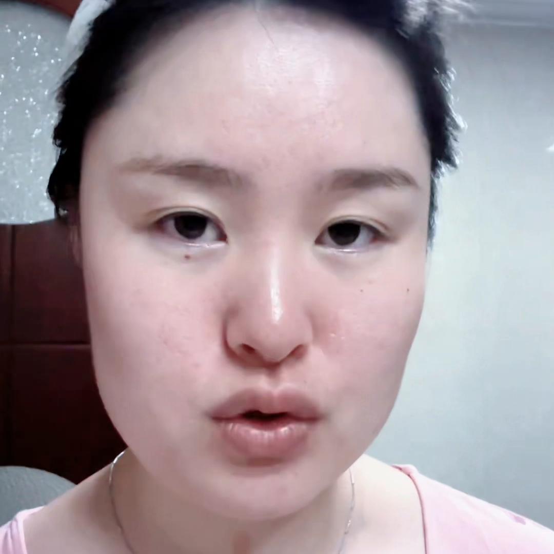 微针怎么修复有效果,水光微针真的有用吗