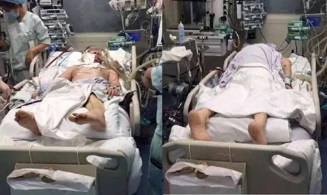 50号病房里的故事（1）——隔壁老王的苦乐年华