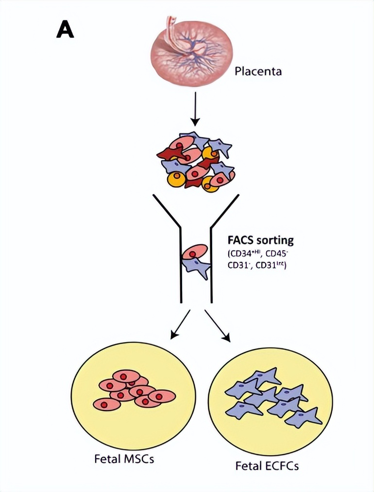 胎盘早剥新生儿重度窒息脑损伤,胎盘不好导致宝宝脑血管畸形