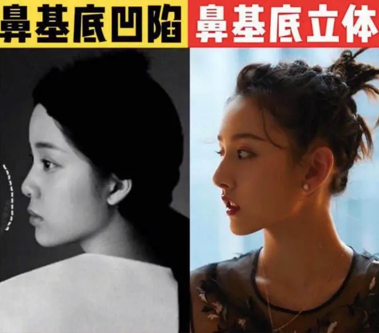 娱乐圈扁头发型,娱乐圈的扁头盘点