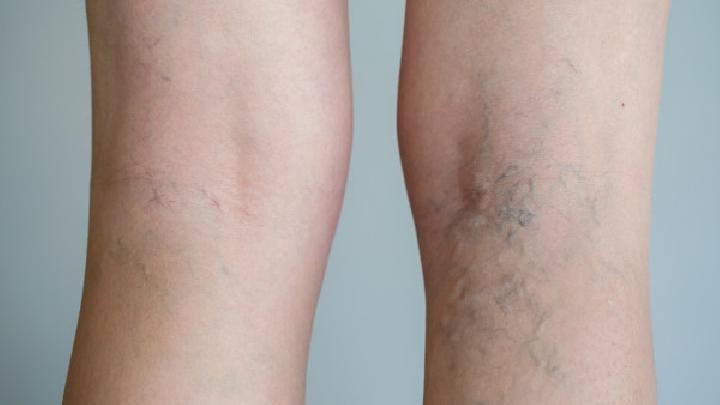 久站不坐会有什么危害,久坐久站会导致哪些危害