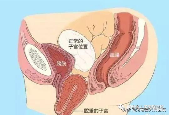 难言之隐小说简介,难言之隐第十二集