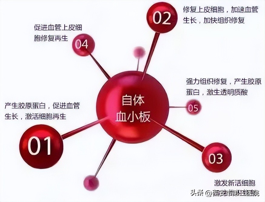 prp治疗膝关节弯曲角度效果,prp治疗膝关节有发热症状