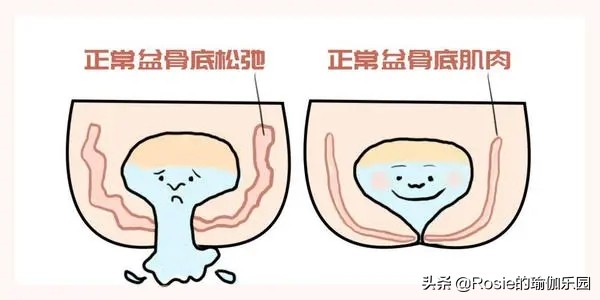 贾静雯三胎是剖腹产还是顺产,贾静雯产后修复