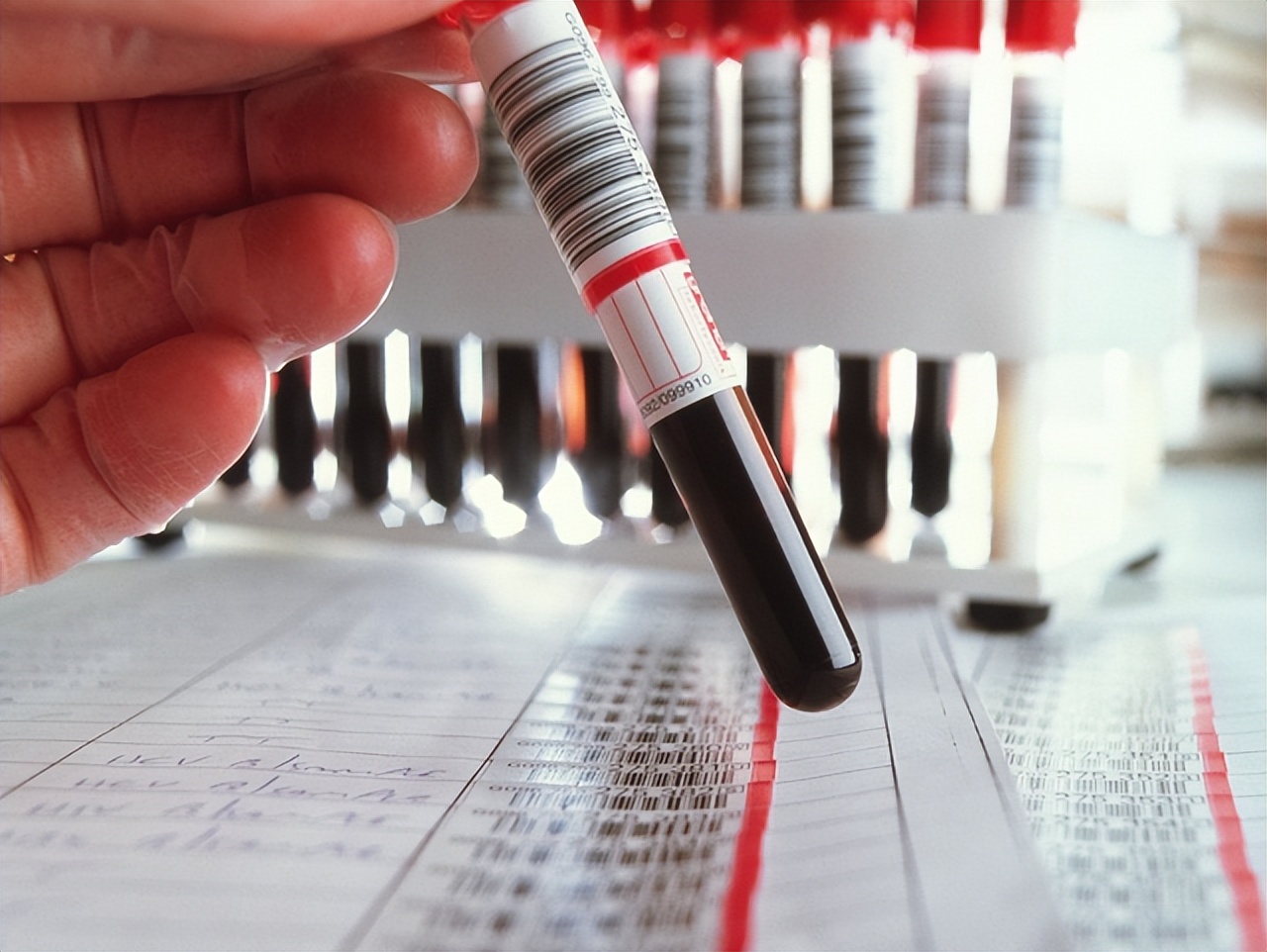 艾滋病毒携带者出现皮肤病怎么办,不要把艾滋病当成皮肤病