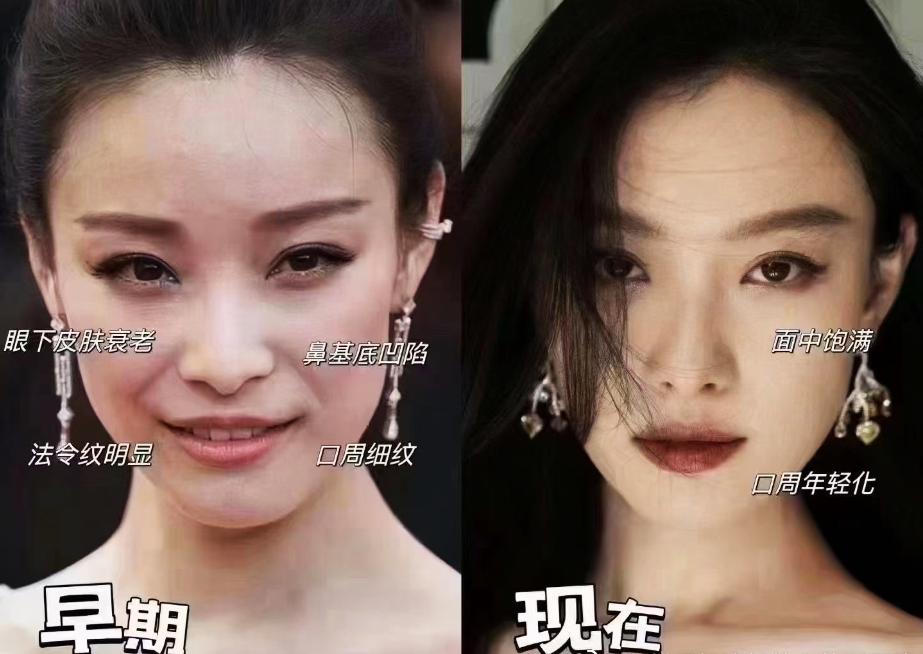 娱乐圈的明星为什么变化那么大,娱乐圈毫无预兆突然变脸的明星