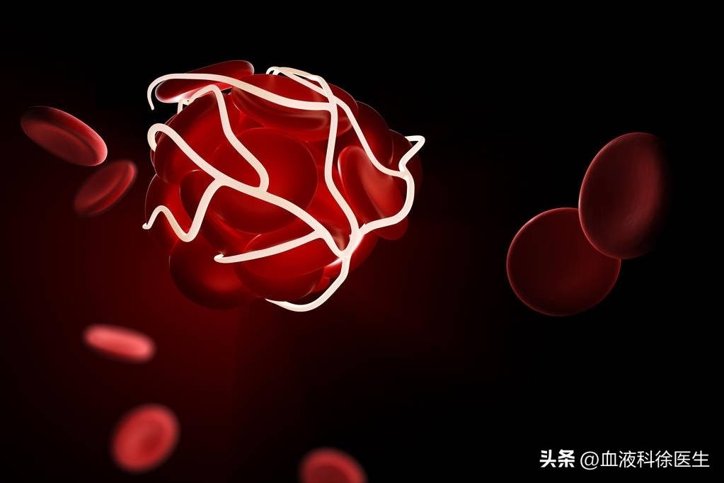 血栓手脚有什么症状和预兆,血栓来临手脚有啥感觉
