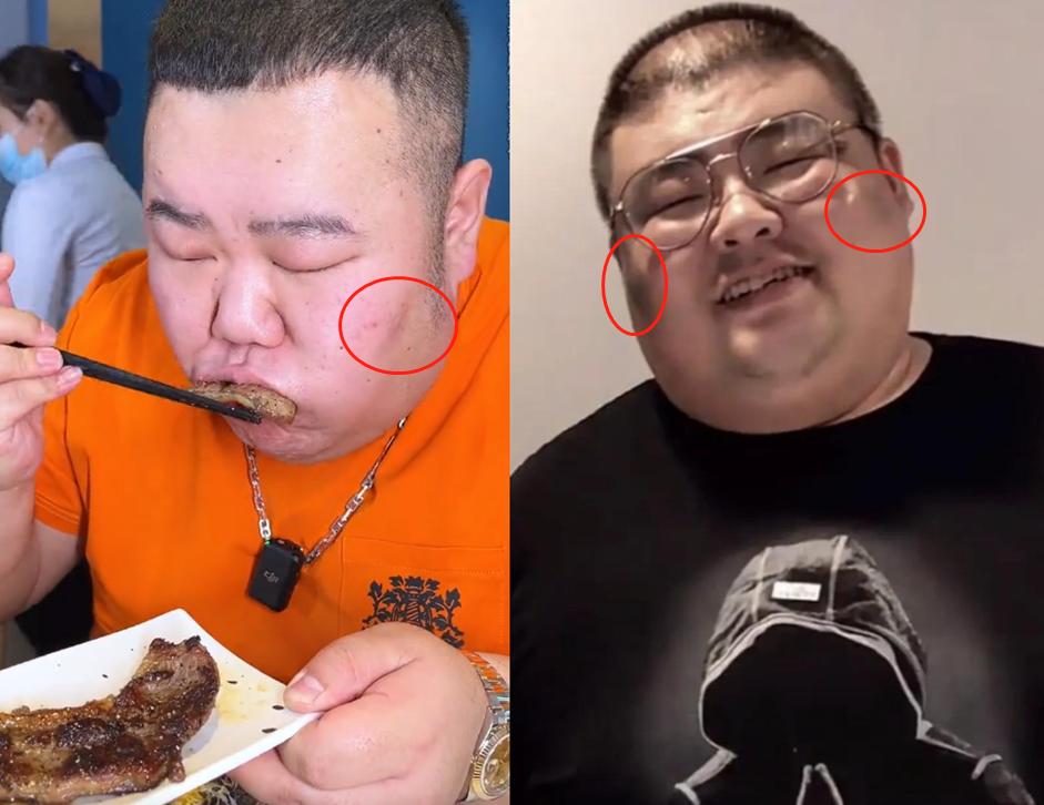 樱木花胖以前多重,网红樱木花胖