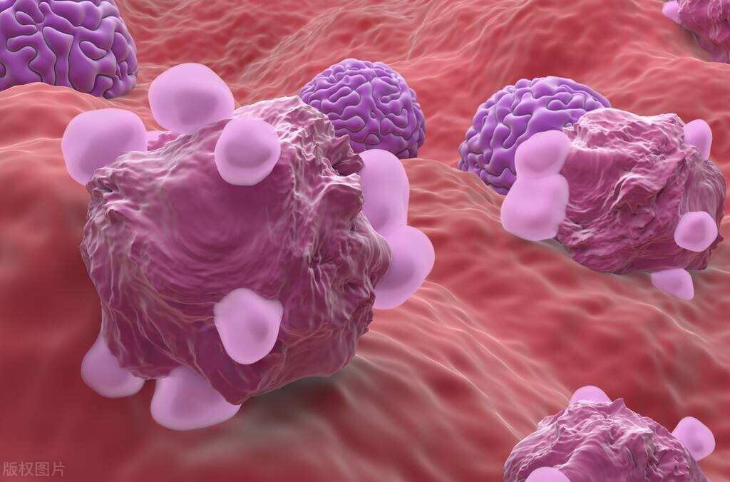 乳胶枕含有毒物质,不仅过敏还致癌?危害有多大?医生说出了真相