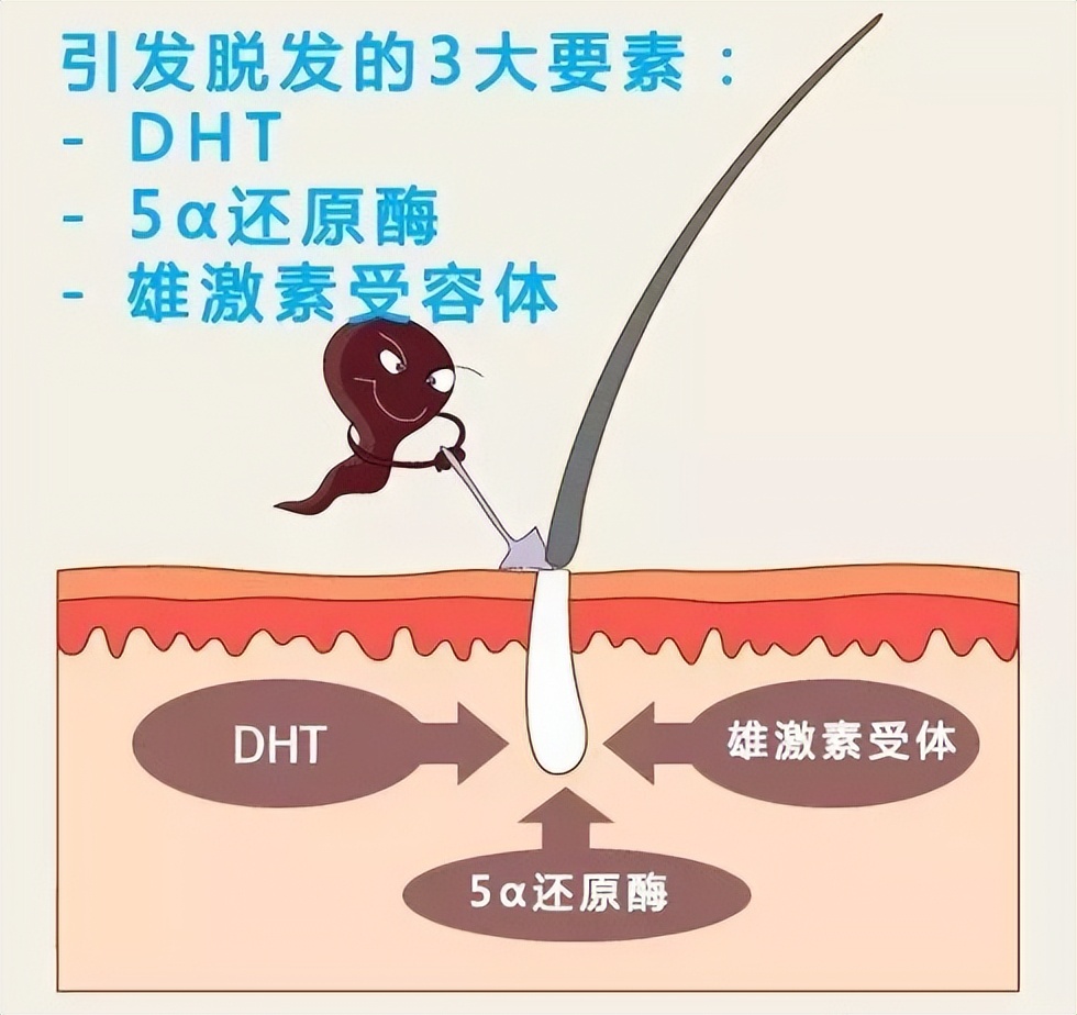 男人50岁性激素下降,男人50岁后雄性激素旺会脱发吗