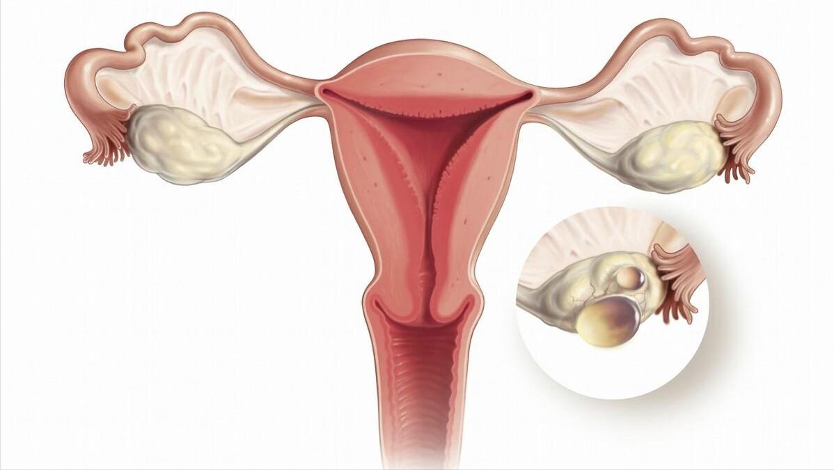 体检查出这十种病不用治疗,真正的医院不建议体检的三种病