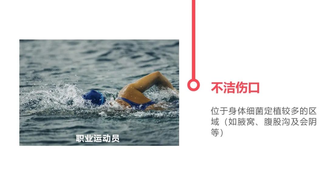 什么样的人最适合得破伤风,容易得破伤风的人有哪些