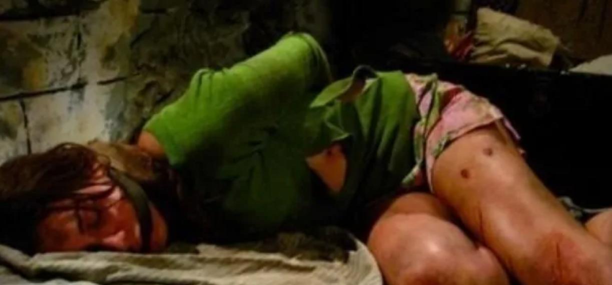 美国最残忍的虐待事件，16岁少女成人形家畜，身上留有150处伤口