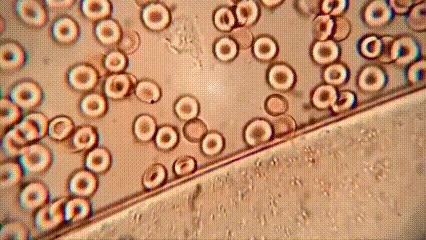 运动神经元显微镜观察内容与结果,显微镜下观察神经元的判断依据