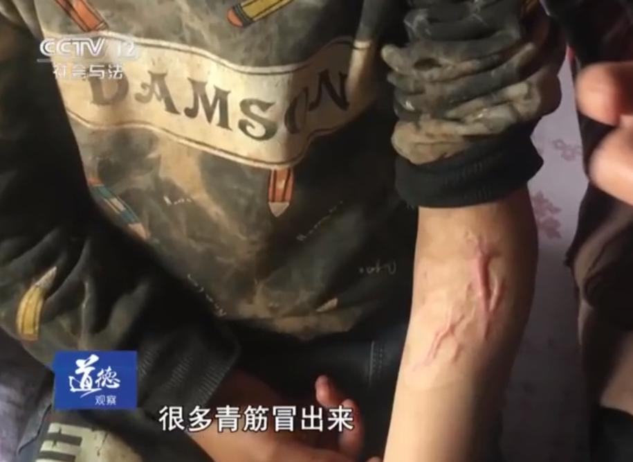 七岁男孩摔破头,7岁男孩头摔破