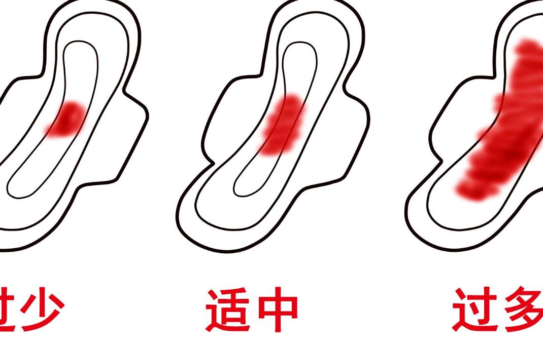 怀孕后还有月经是怎么回事,月经和怀孕会同时来吗