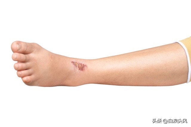 租房东西被老鼠咬了责任算谁的,在宾馆被老鼠咬了赔偿什么费用