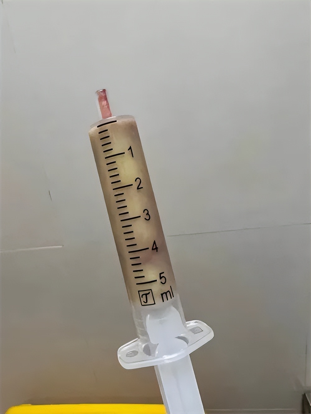 00后打耳洞,00后女生打耳洞感染