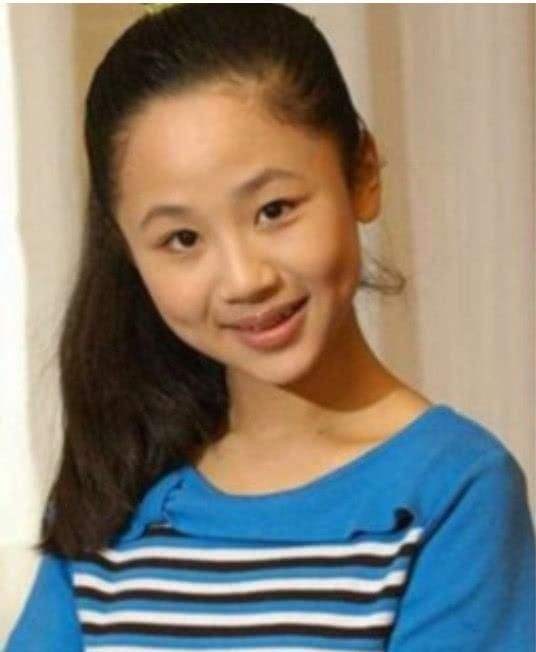 法令纹泛红暗沉做什么医美,法令纹早睡早起消除得了吗