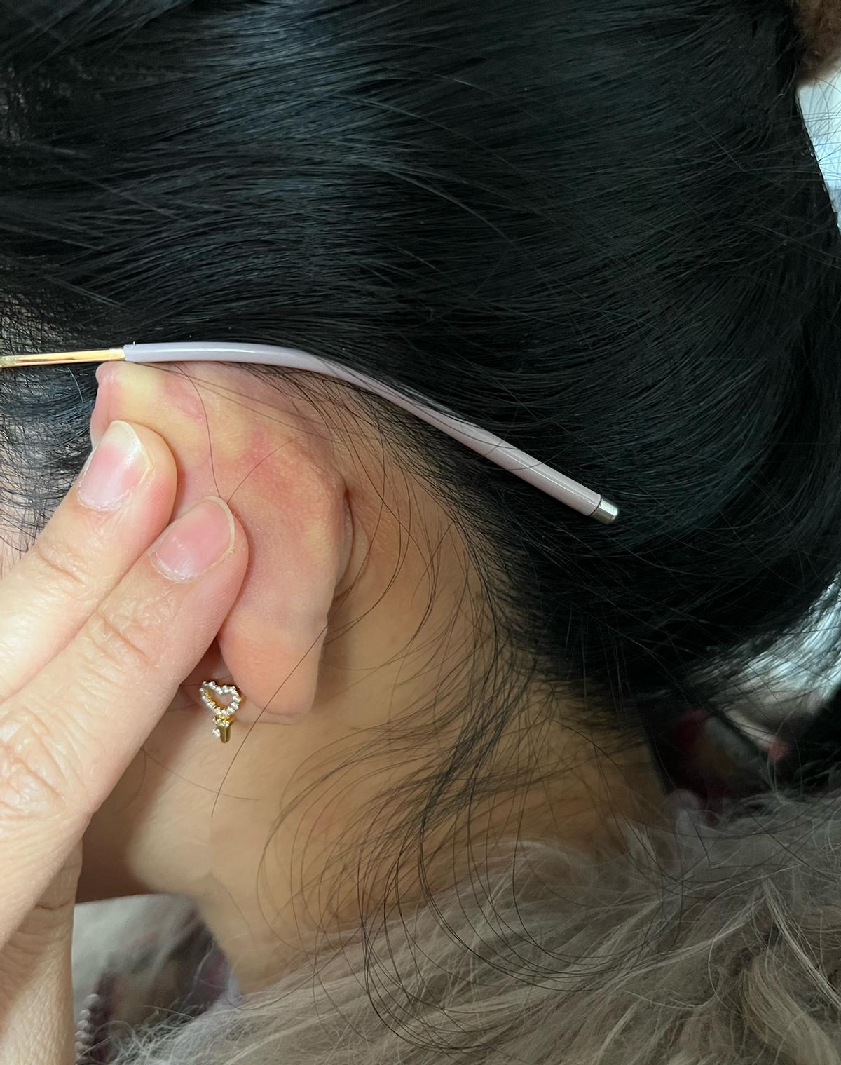 眼镜变形下滑如何解决,眼镜歪了变形了怎么办