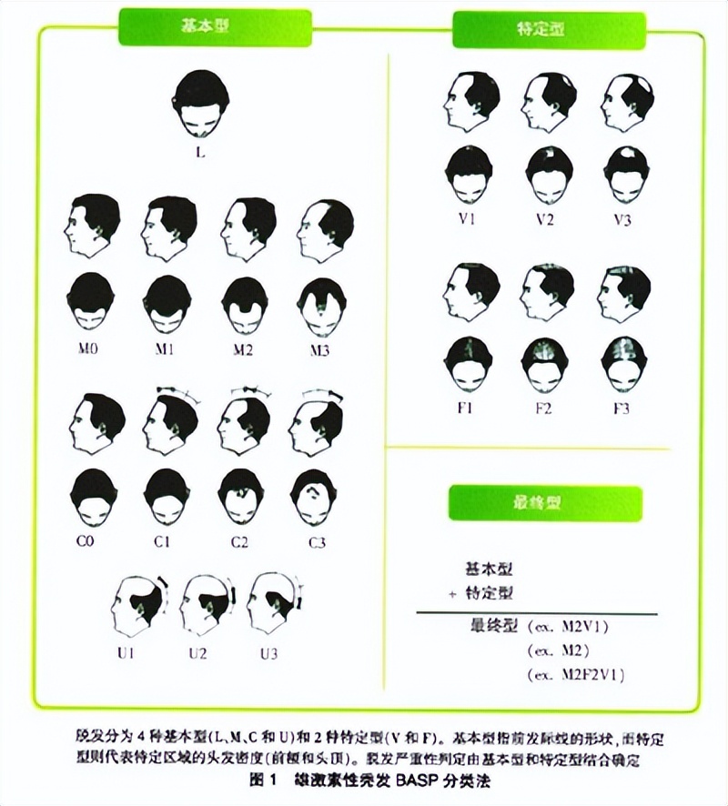 雄秃是哪里出了问题,雄秃真的无解吗