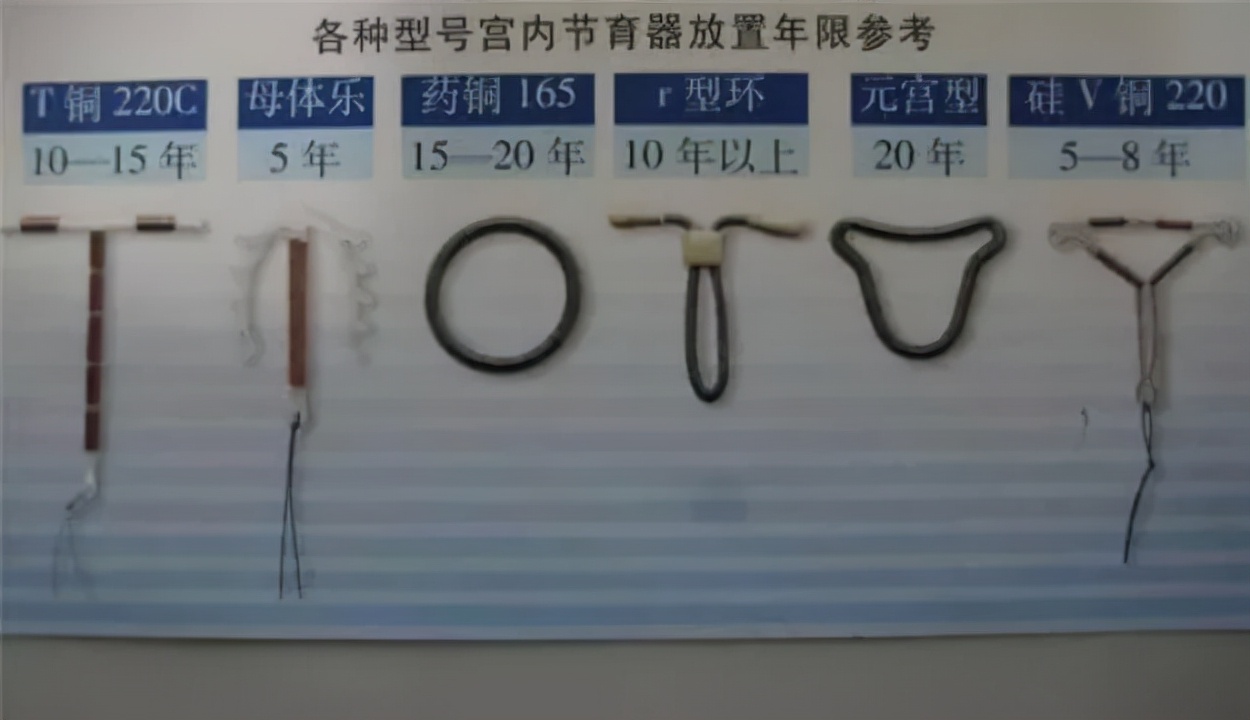 节育环“超期服役”惹祸端,正确的避孕方式是什么?