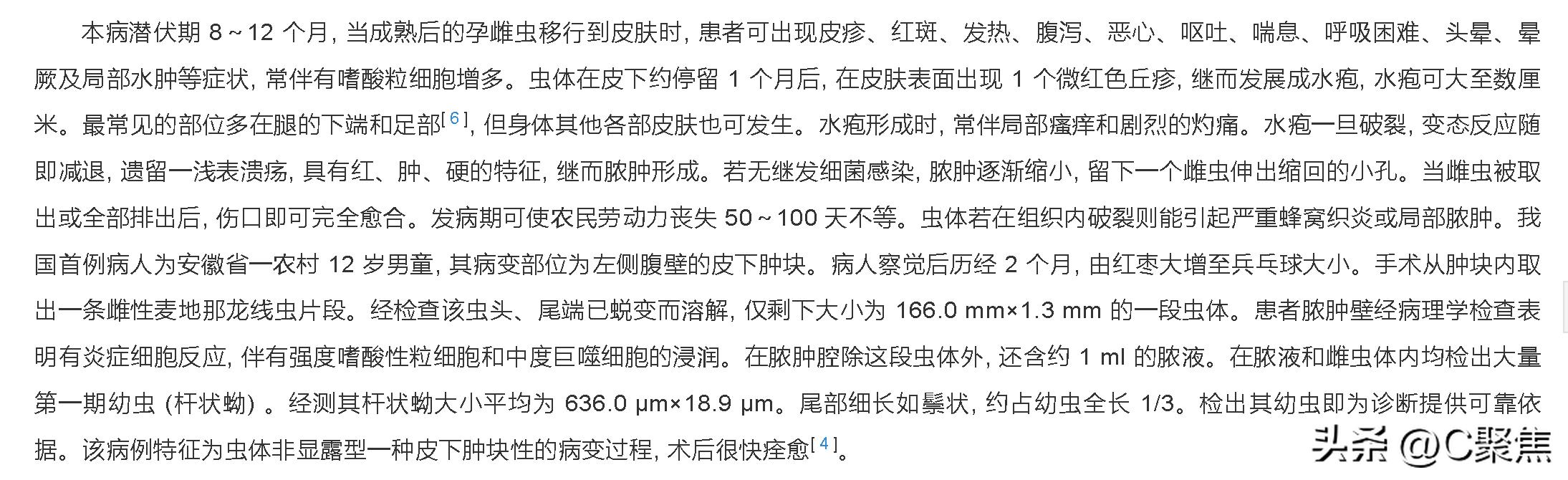四川惊现入侵物种致命寄生龙线虫,四川发现的是龙线虫吗
