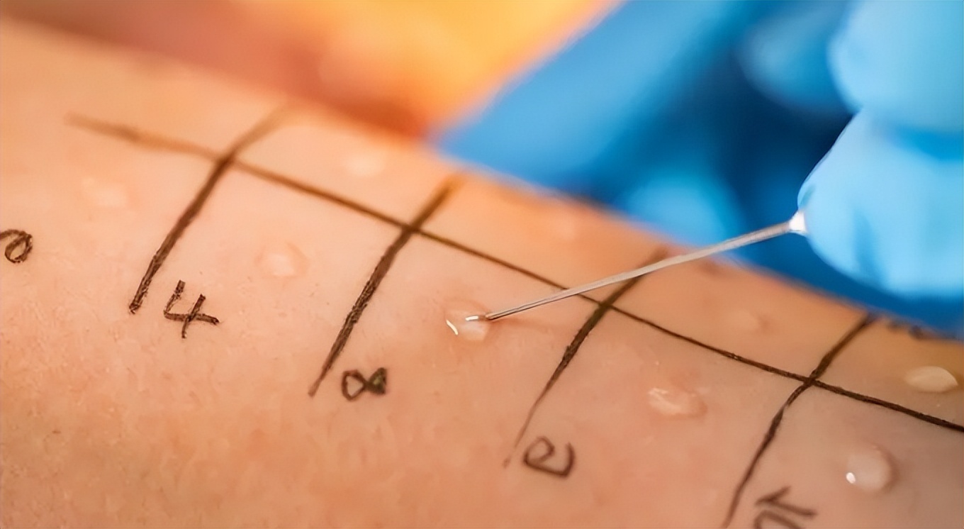 过敏性鼻炎一直鼻塞不通气怎么办,过敏性鼻炎鼻塞流鼻涕打喷嚏眼痒