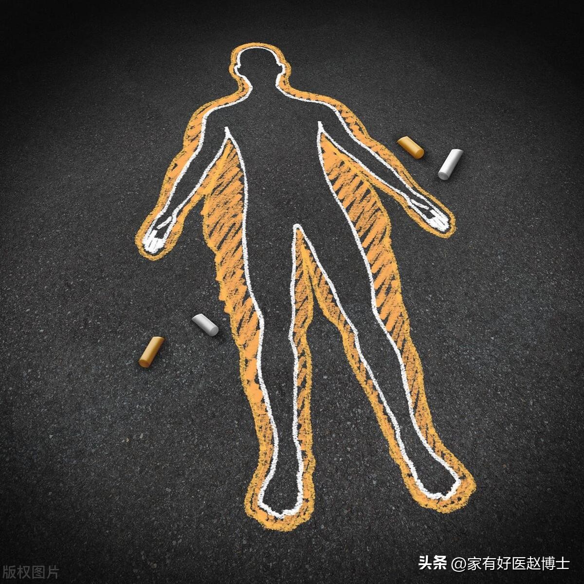 “缓解/逆转”2型糖尿病，具体有三种方法！适用的情况各不相同