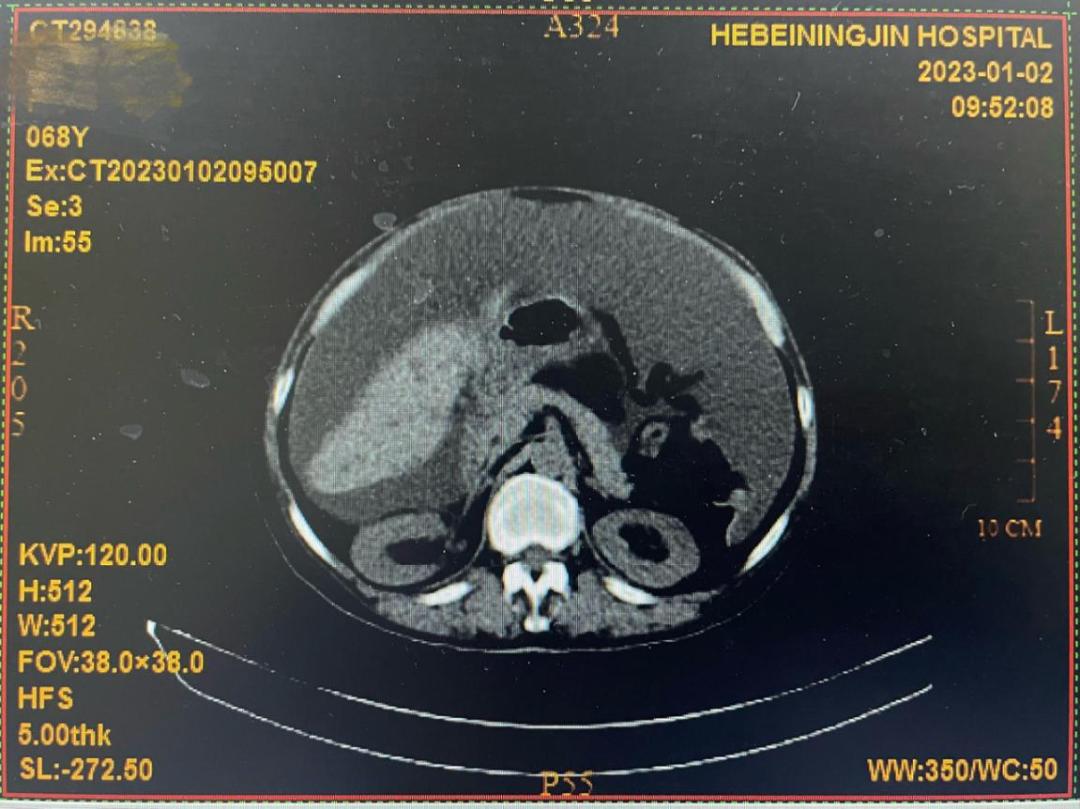 肿瘤君催泪片段,肿瘤君主题曲