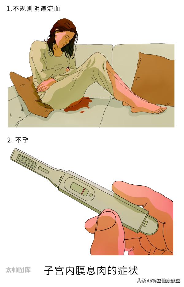 滴滴答答不干净，可能是这个地方长息肉了